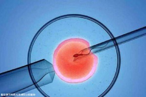 单基因病案例